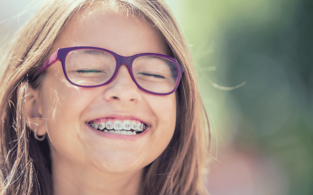 Protecting Your Smile: Can You Wear a Mouth Guard with Braces?