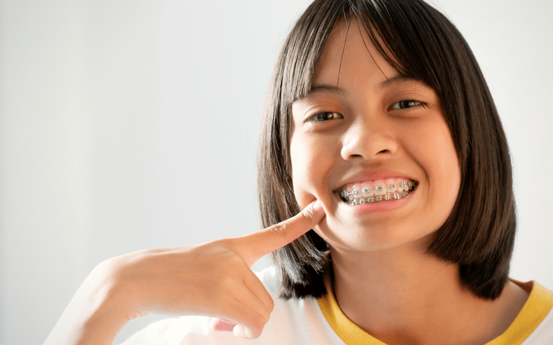 Getting Back to School with Braces | Quick Tips for Parents